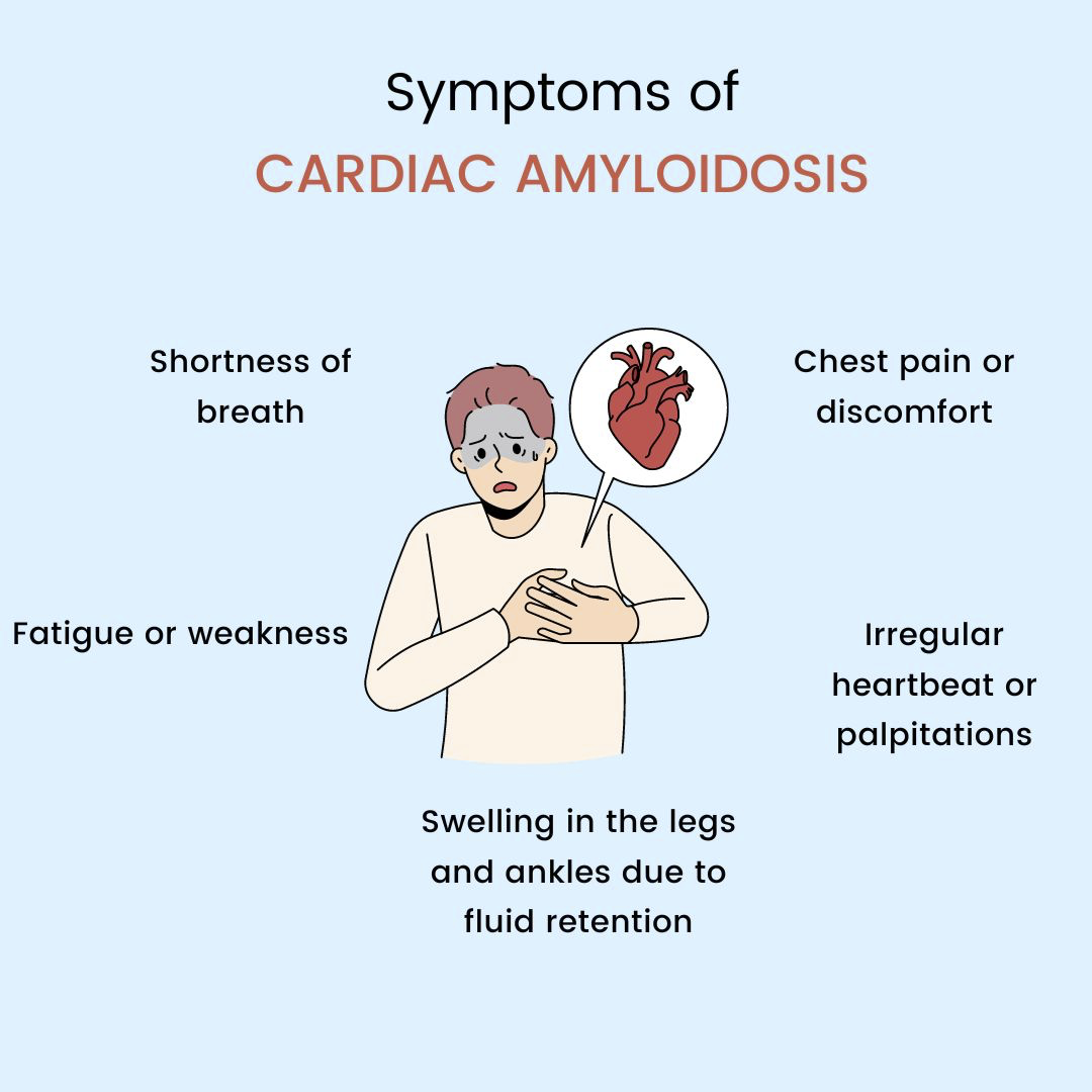 Graphics of Cardiac Symptoms